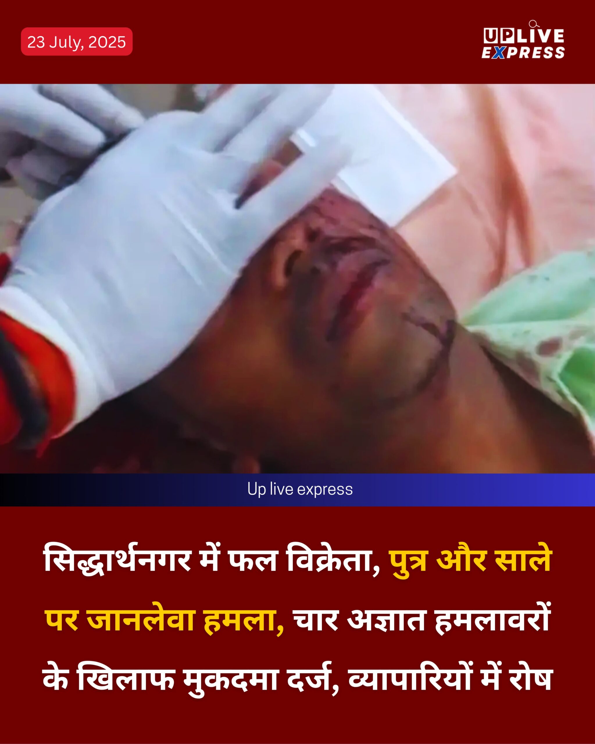 सिद्धार्थनगर में फल विक्रेता, पुत्र और साले पर जानलेवा हमला, चार अज्ञात हमलावरों के खिलाफ मुकदमा दर्ज, व्यापारियों में रोष :