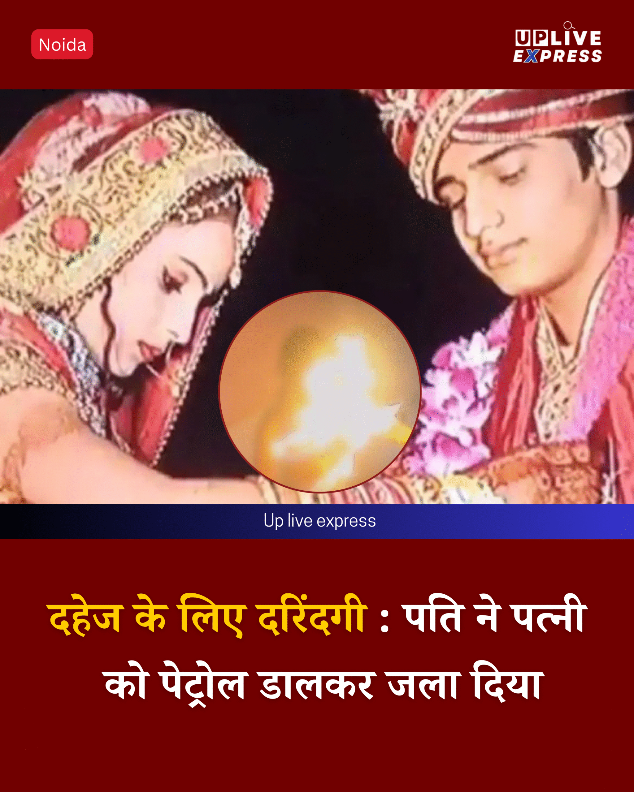 नोएडा हत्याकांड: बेटे के सामने पत्नी को जिंदा जलाया, दहेज में 35 लाख की मांग थी :